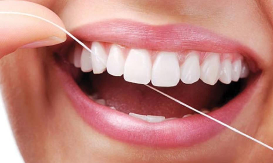 5 Cara Alami Menghilangkan Karang Gigi