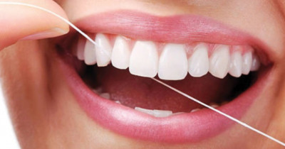 5 Cara Alami Menghilangkan Karang Gigi
