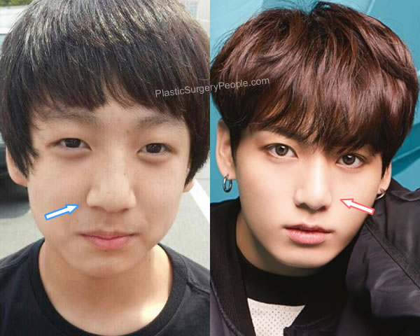 Apakah Mata Jungkook BTS Oplas? Lihat Perbandingan Wajahnya di sini