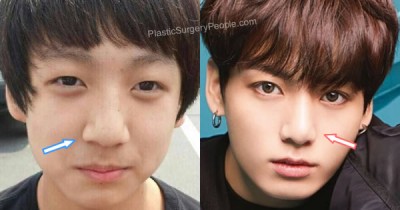 Apakah Mata Jungkook BTS Oplas? Lihat Perbandingan Wajahnya di sini