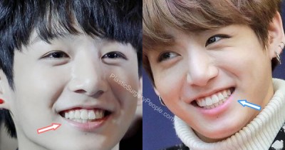 Apakah Bibir Jungkook BTS Oplas? Coba Lihat Perbandingan Wajahnya di sini