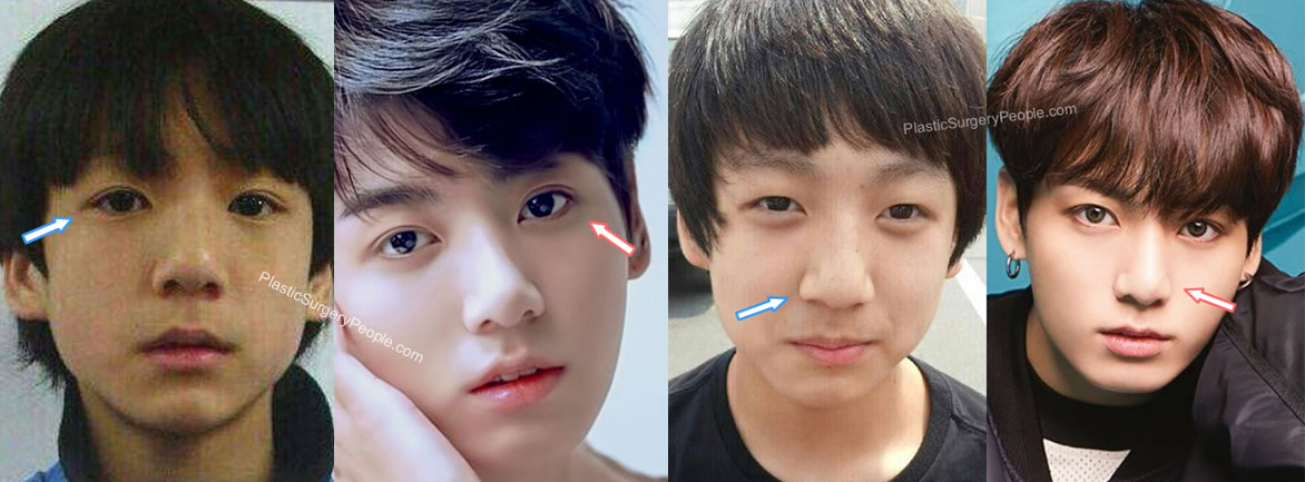 Apakah Jungkook Operasi Plastik 'Oplas'? Lihat Perbandingan Wajahnya di ...